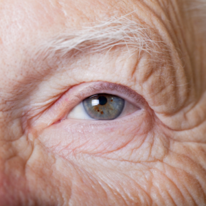 Read more about the article 10 Common Old Age Problems That Senior Citizens Should Be Aware Of